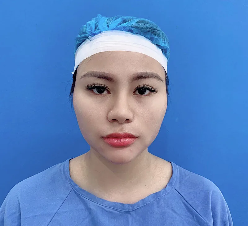 Người có phần gò má cao, nhô ra rõ rệt, tạo cảm giác khuôn mặt góc cạnh